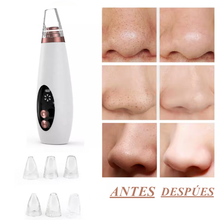 Cargar imagen en el visor de la galería, Succionador de poros
